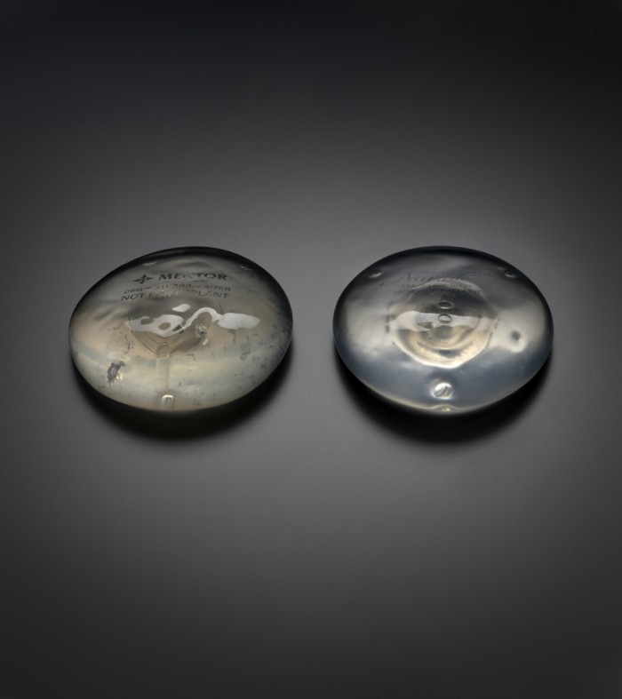 Breast implants on display in the exhibition, representing the relationship between fashion and body modification.